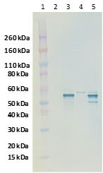 Rabbit anti-CCHFV N protein pAb Western Blot Data: Performed with CCHFV infected Vero cell lysates and HEK293T cell lysates transfected with recombinant CCHFV N protein (lanes 3 and 5, respectively). Mock infected Vero cell lysate (lane 2) and mock transfected HEK293 cell lysate (lane 4) were also used as negative controls. Blots were detected using antiCCHFV N pAb at 5 ng/mL and visualized using an anti-rabbit HRP conjugate and chromogenic substrate (CCHFV N shown by arrow).