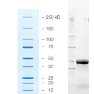 Recombinant DNAse 1 (RNAse-Free)
